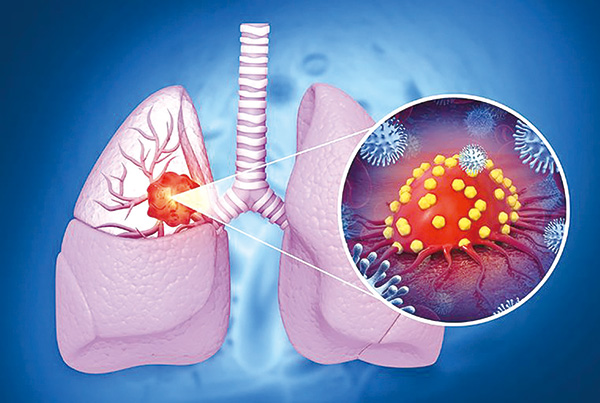 379-380期(完成)-17.jpg 379-380期(完成)-17.jpg