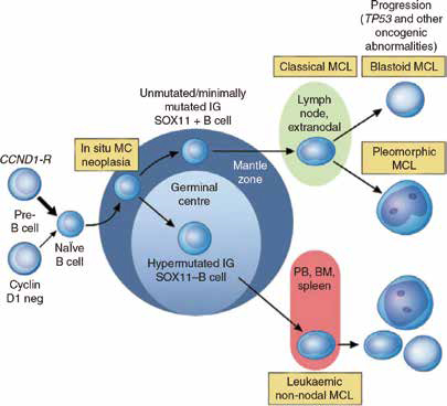 cBTKi治疗中国MCL患者的特征谱