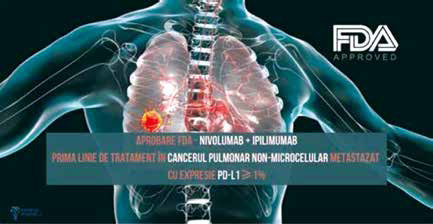 一线治疗晚期NSCLC 纳武利尤单抗联合伊匹单抗有持久生存获益